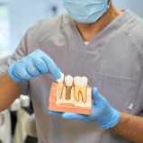 Healing and Integration Dental Implant